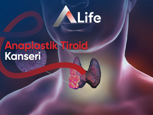 Anaplastik Tiroid Kanseri